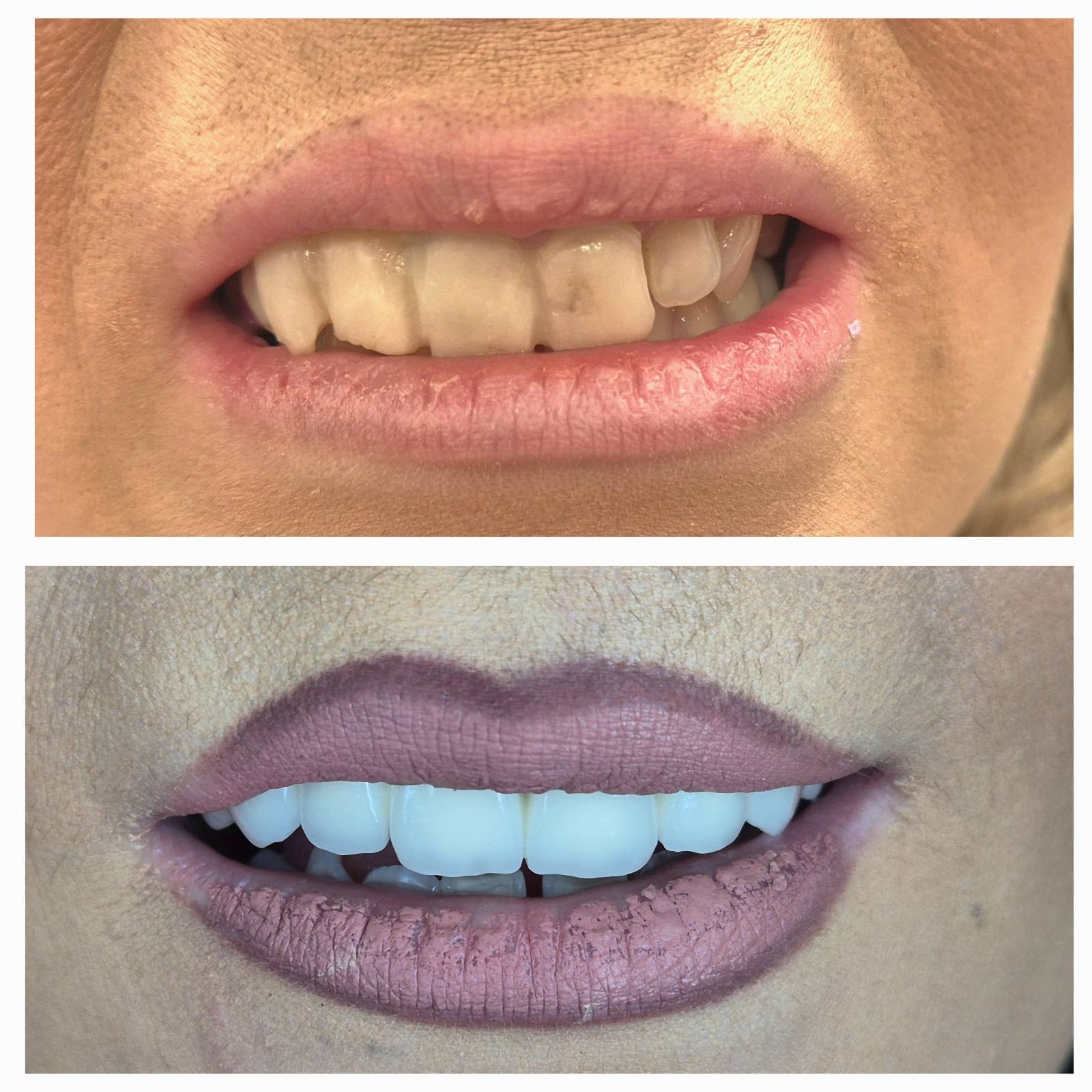 Dental Estetic - Rezultat 1