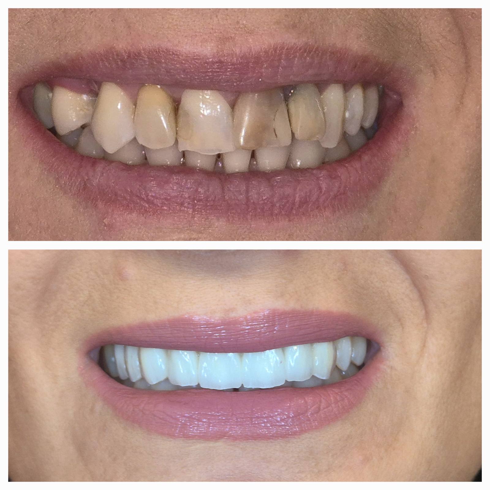 Dental Estetic - Rezultat 2