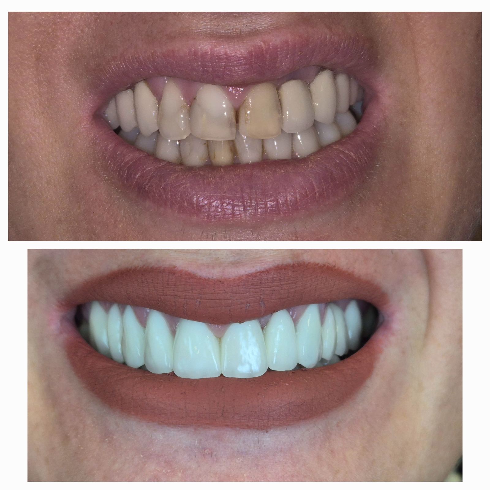 Dental Estetic - Rezultat 3