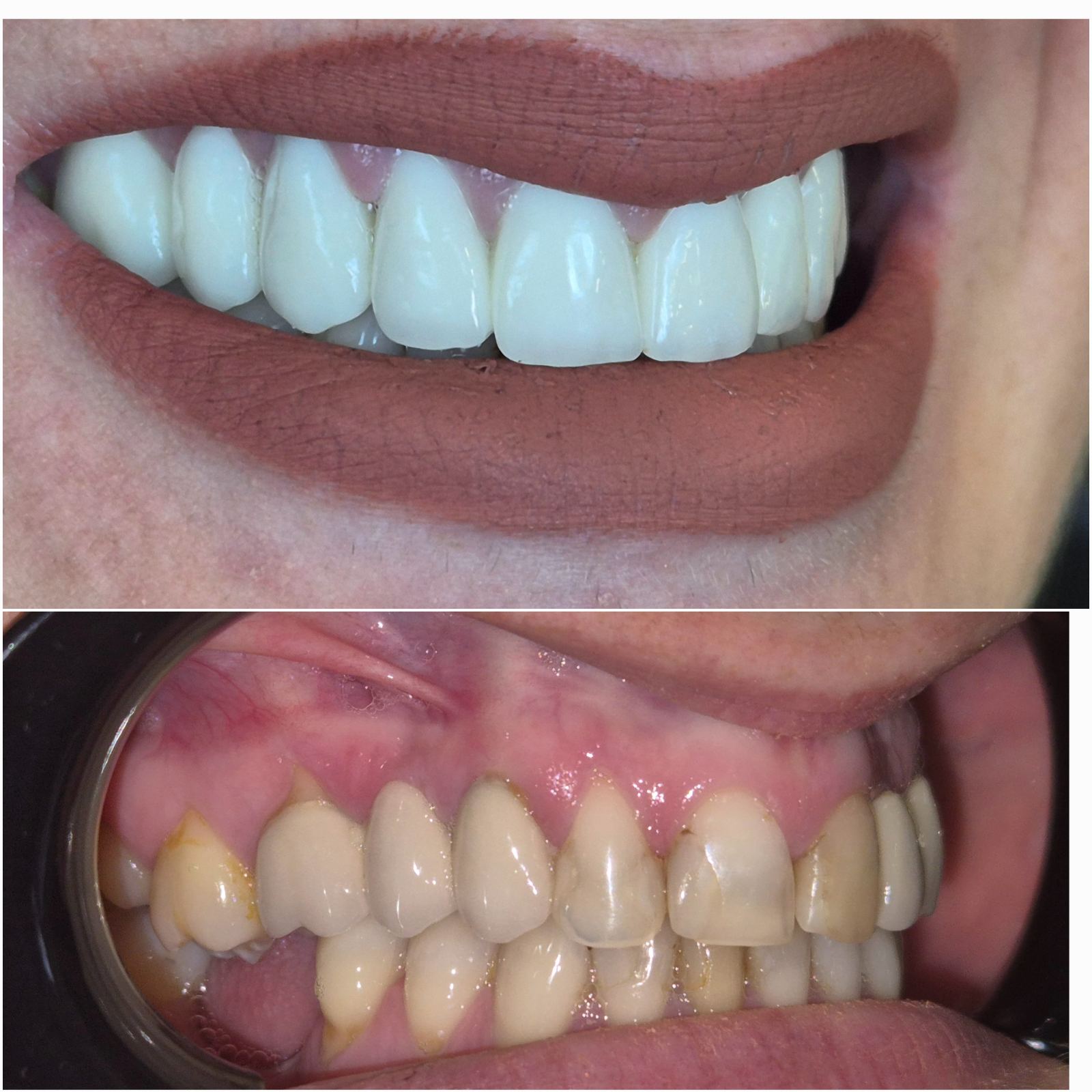Dental Estetic - Rezultat 4