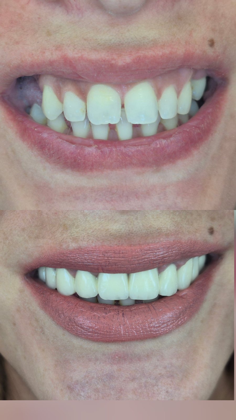 Dental Estetic - Rezultat 5