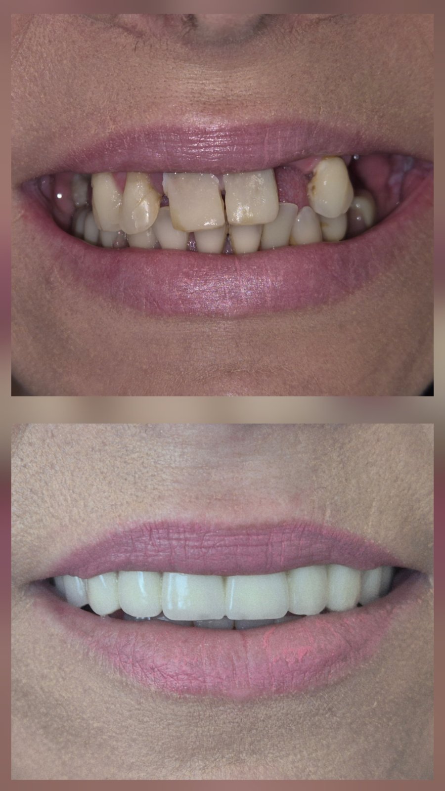 Dental Estetic - Rezultat 6