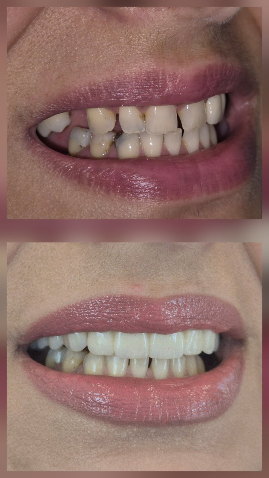 Dental Estetic - Rezultat 7