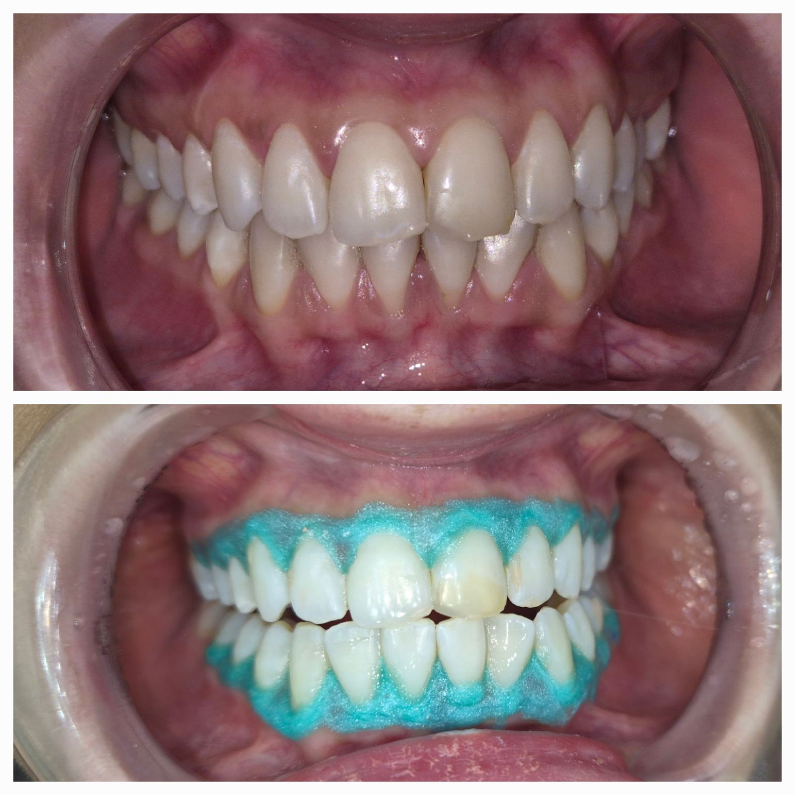 Dental Estetic - Rezultat 8