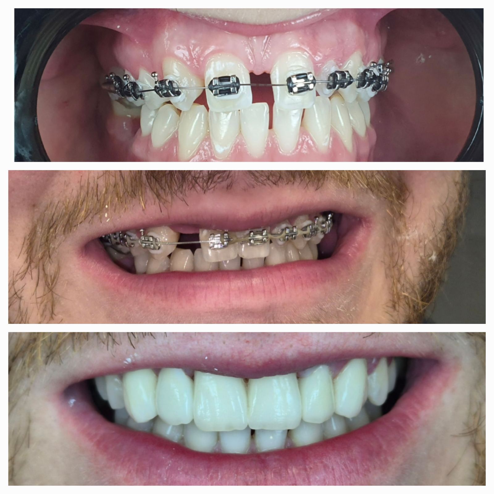 Dental Estetic - Rezultat 9
